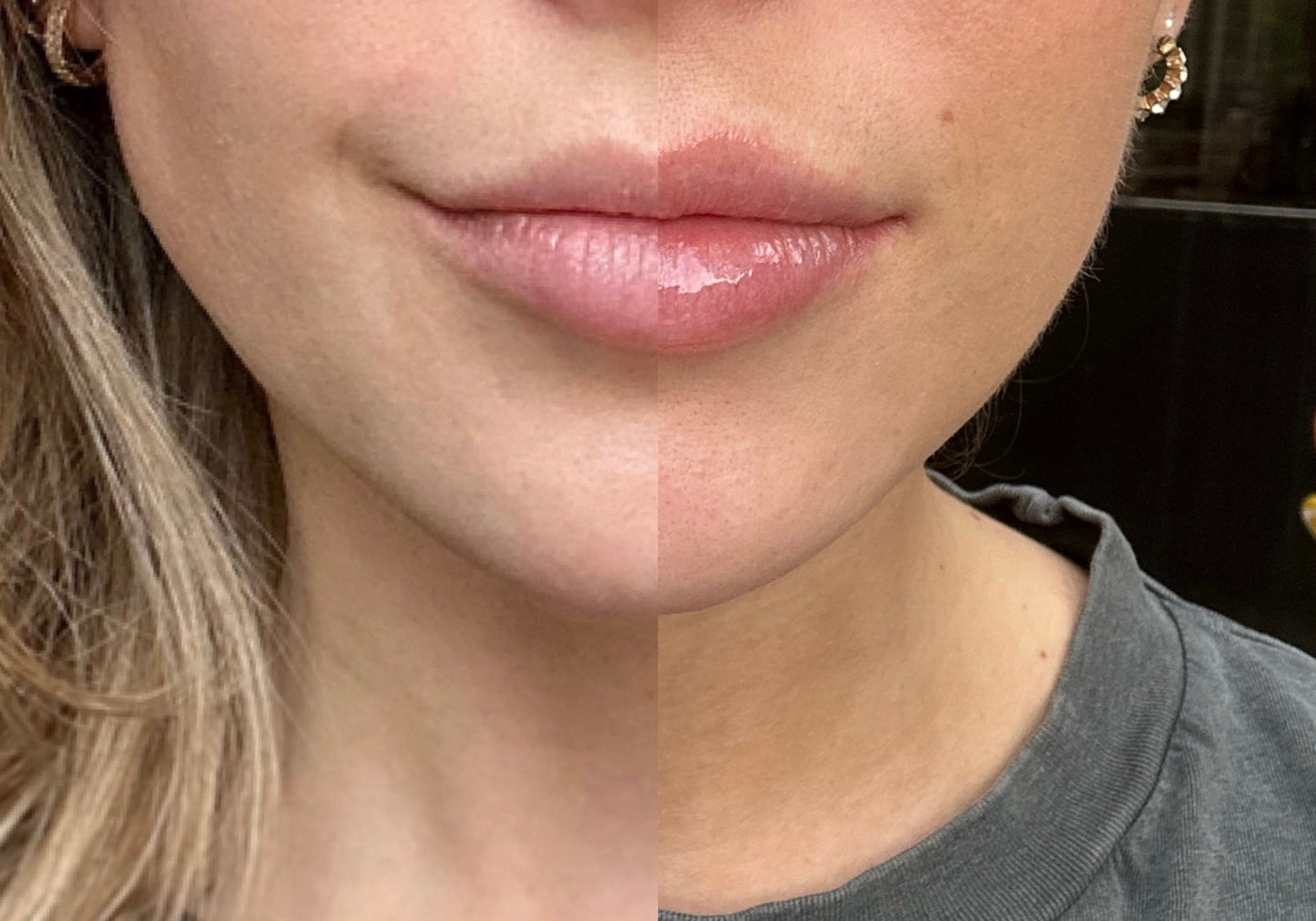 LIP + LASH